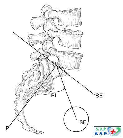 脊柱-骨盆矢状面平衡参数 - 骨科知识汇编 - 骨科知识汇编