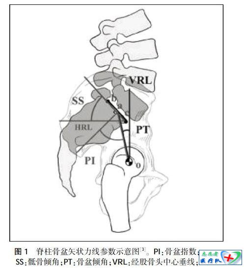 脊柱-骨盆矢状面平衡参数 - 骨科知识汇编 - 骨科知识汇编