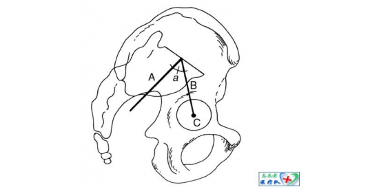 脊柱-骨盆矢状面平衡参数