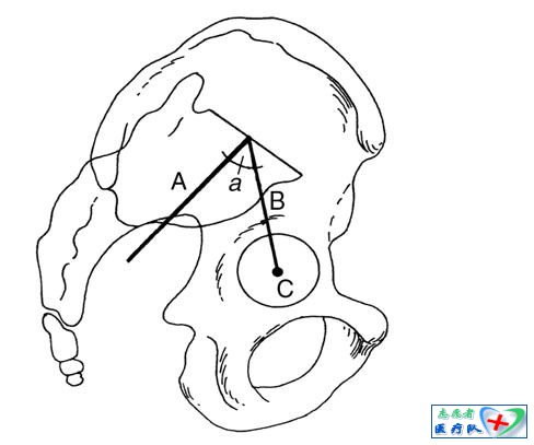 脊柱-骨盆矢状面平衡参数 - 骨科知识汇编 - 骨科知识汇编