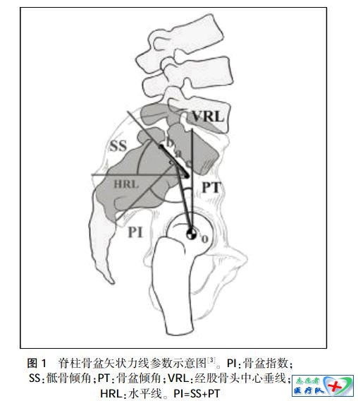脊柱骨盆矢状力线 - 骨科知识汇编 - 骨科知识汇编
